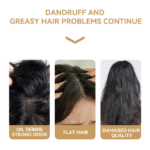 Oil-Control Shampoo