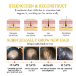 Anti-Hair Loss Shampoo